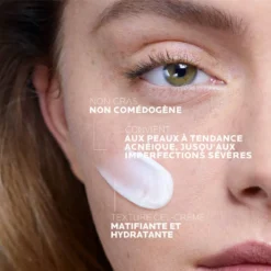 Application du soin La Roche-Posay Effaclar Duo+ M sur une peau à tendance acnéique.