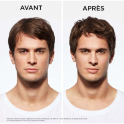 Comparaison avant et après l'utilisation de la gamme Genesis Homme pour la réduction de la chute de cheveux