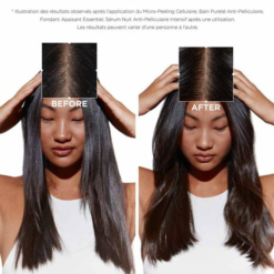 Avant et après application de Kérastase Symbiose sur cuir chevelu sensible