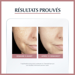 Résultats prouvés avant et après 12 semaines avec le soin Anti-Pigment Eucerin.