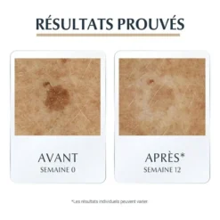 Résultats prouvés avant et après 12 semaines d'utilisation de Eucerin.