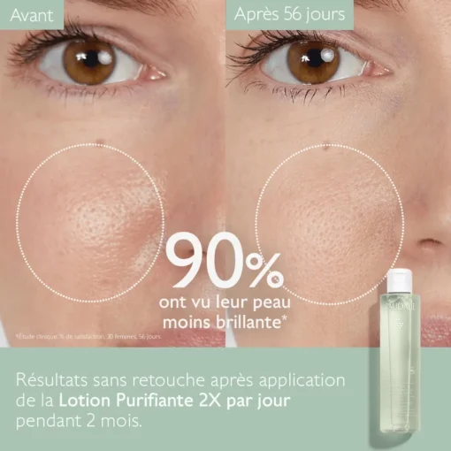 Résultats après 56 jours d'utilisation de la Lotion Purifiante Caudalie Vinopure, réduction de la brillance de la peau.