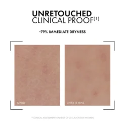 Preuve clinique non retouchée montrant les effets hydratants de la crème Vichy Minéral 89